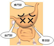 胃は消化管を成す管状の器官で、食道につながる噴門部と十二指腸につながる幽門部、それ以外の部分を胃体部と呼びます